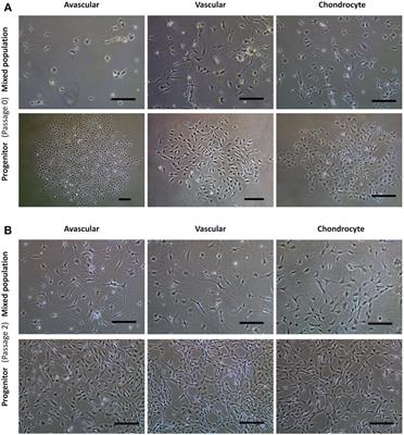 Phenotypic characterization of regional human meniscus progenitor cells